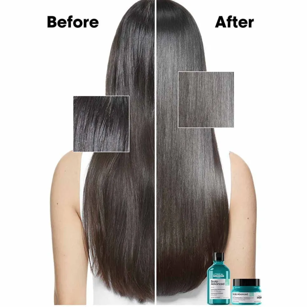L'Oréal Professionnel Serie Expert Scalp Advanced Anti-Oiliness Dermo Purifier Shampoo 300ml