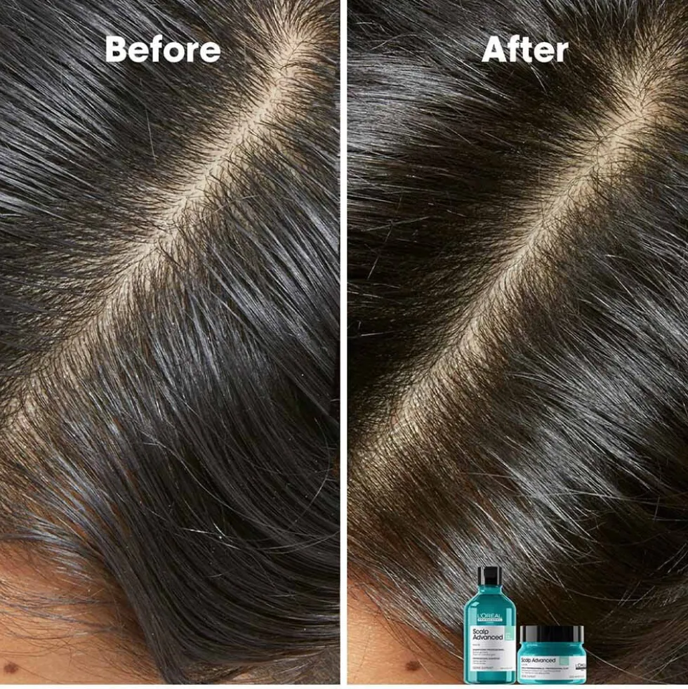 L'Oréal Professionnel Serie Expert Scalp Advanced Anti-Oiliness Dermo Purifier Shampoo 300ml