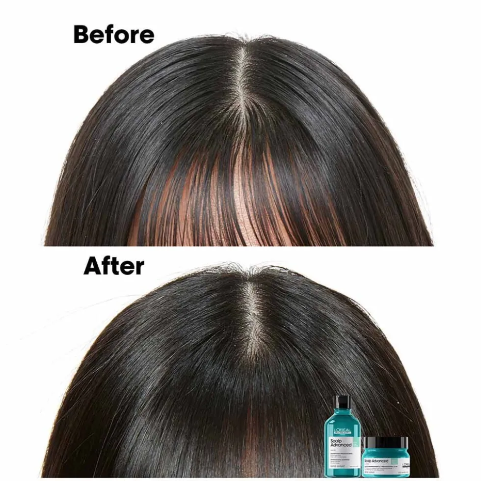 L'Oréal Professionnel Serie Expert Scalp Advanced Anti-Oiliness Dermo Purifier Shampoo 300ml