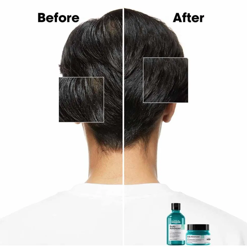 L'Oréal Professionnel Serie Expert Scalp Advanced Anti-Oiliness Dermo Purifier Shampoo 300ml