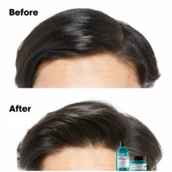 L'Oréal Professionnel Serie Expert Scalp Advanced Anti-Oiliness Dermo Purifier Shampoo 300ml