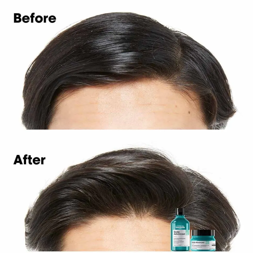 L'Oréal Professionnel Serie Expert Scalp Advanced Anti-Oiliness Dermo Purifier Shampoo 300ml