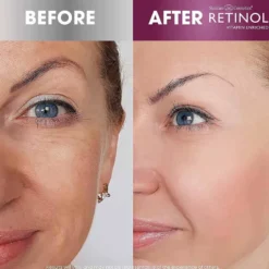 Retinol Anti-Aging Gel Cleanser 120ml