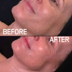 Skintruth Nourishing Facial Kit for Normal & Dry Skin