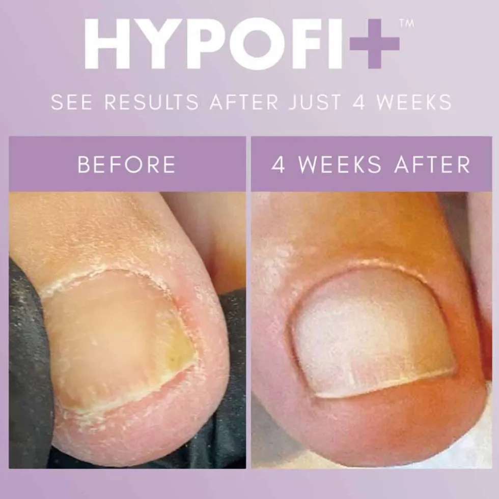 The Gel Bottle Inc. Hypofix Repair 7ml